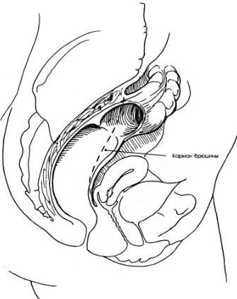Анатомия органов малого таза у женщин в картинках